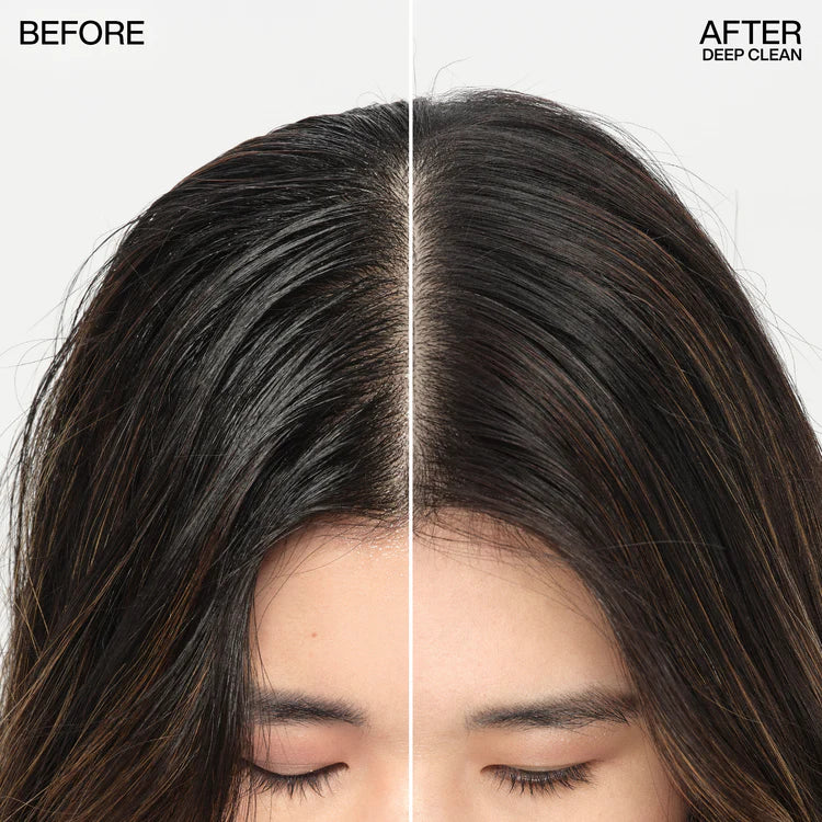 Redken Deep Clean Dry Shampoo 88G —  — Image 7