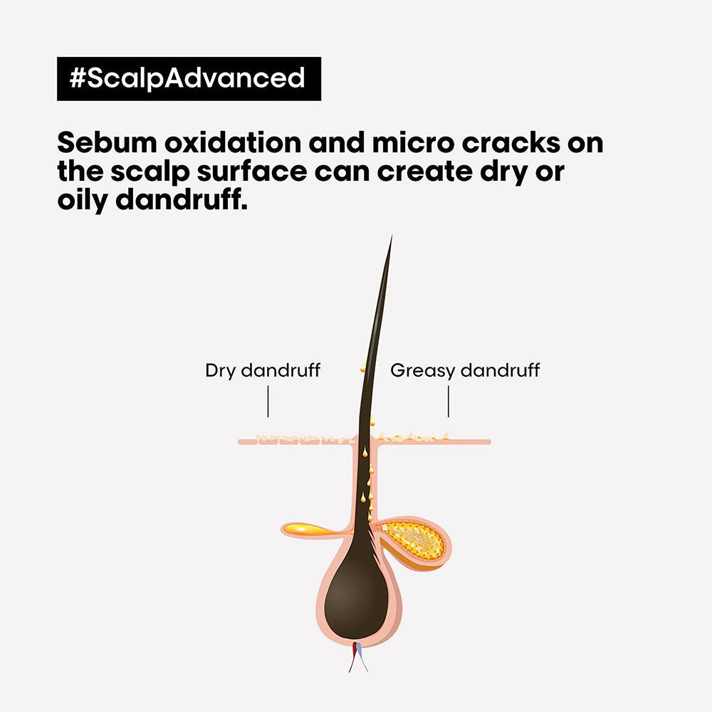 L'Oréal Professionnel Scalp Advanced Anti-Dandruff Shampoo 1500ml product image 3 - L'Oréal Professionnel salon hair care
