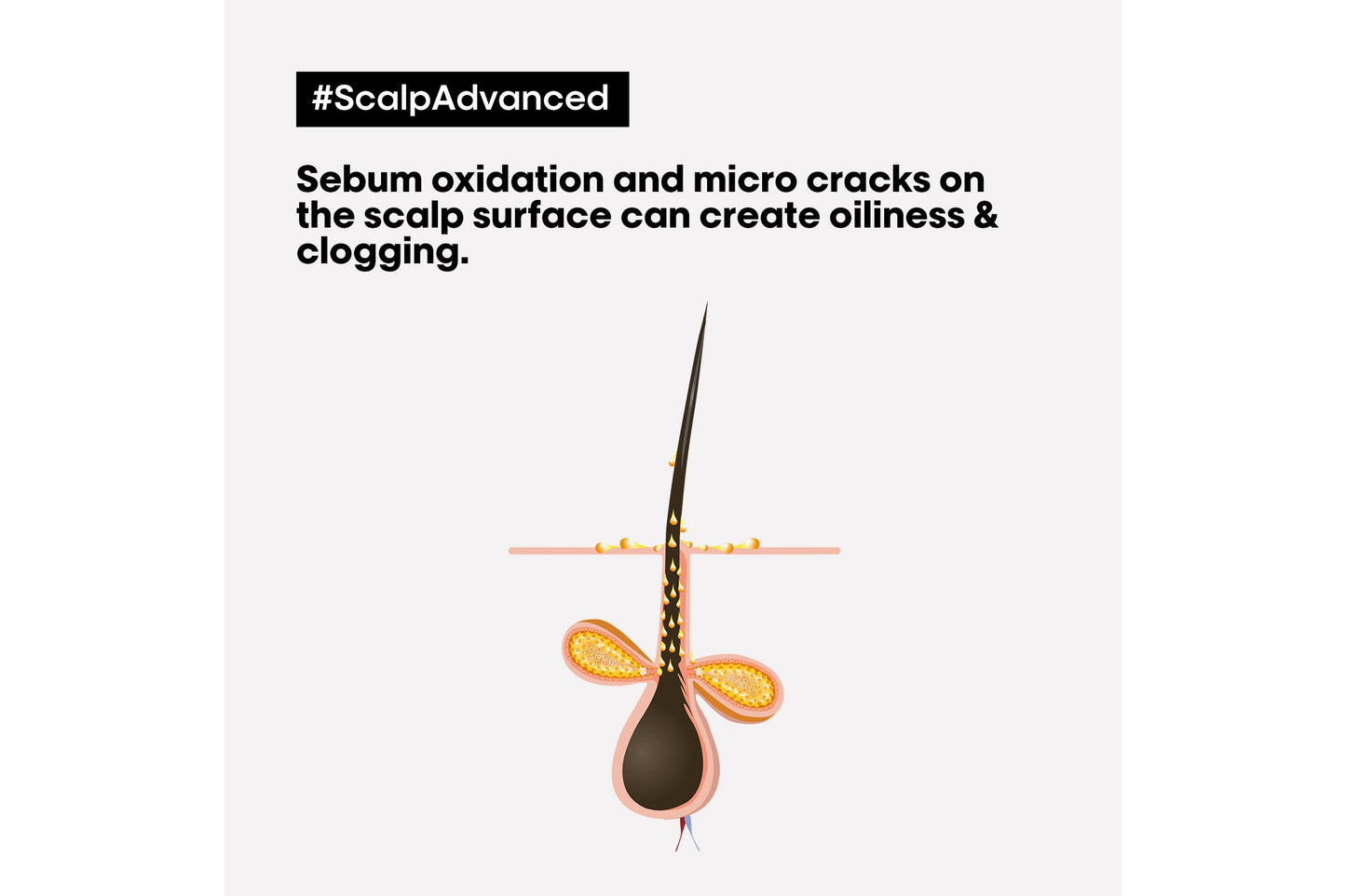 L'Oréal Professionnel Scalp Advanced Anti-Oiliness Mask 250ml