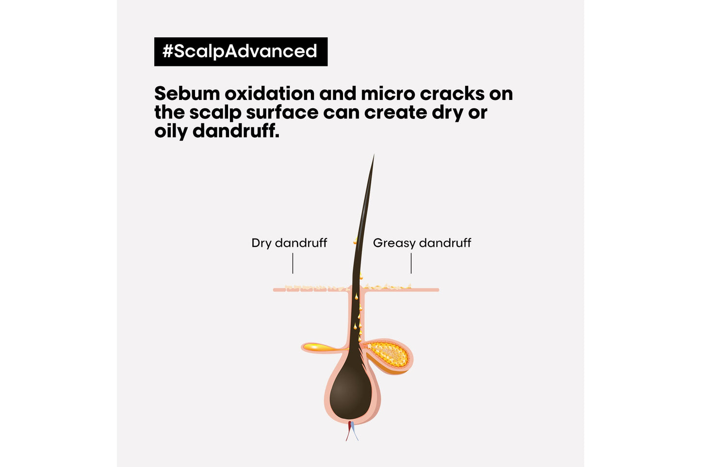L'Oréal Professionnel Scalp Advanced Dandruff Shampoo 300ml