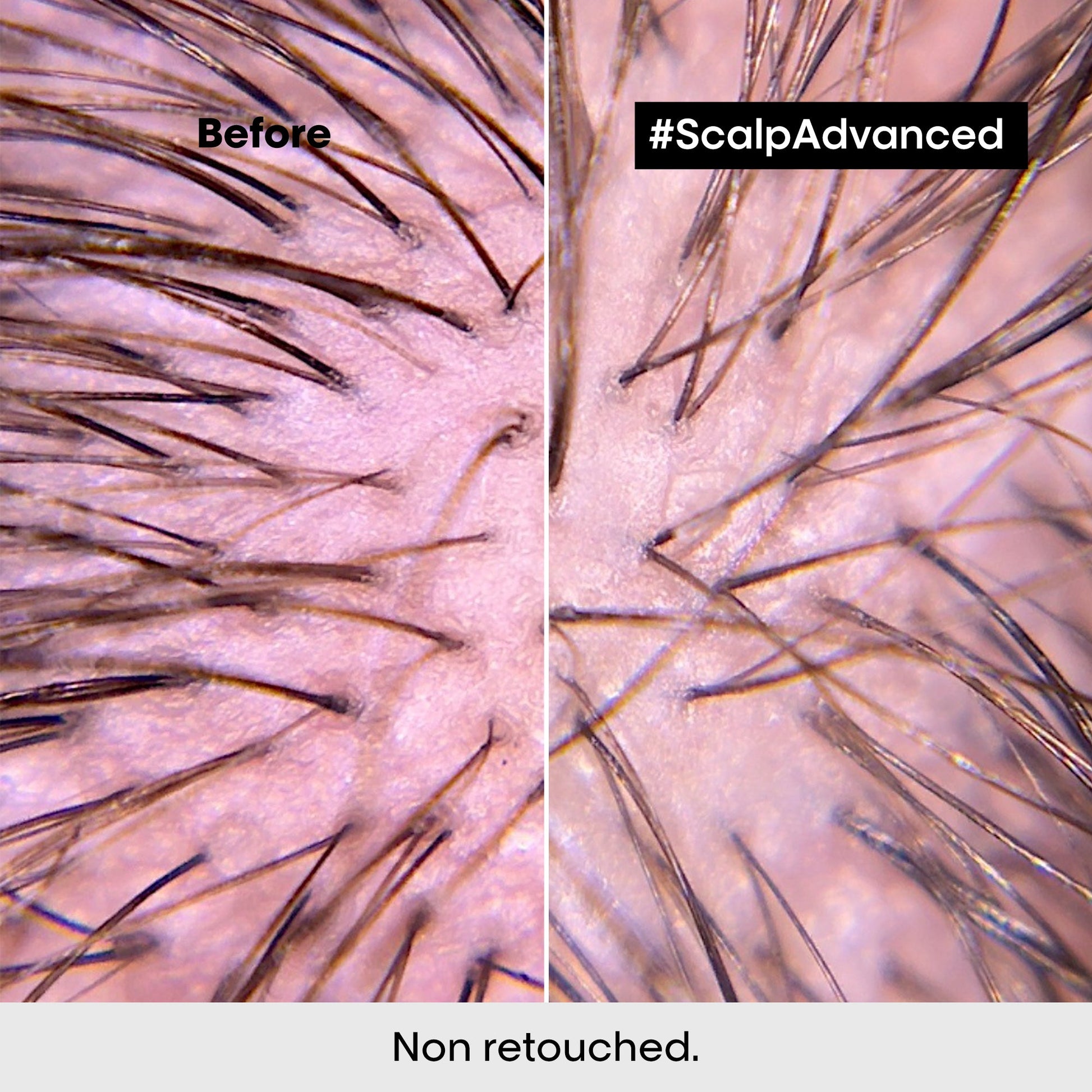 L'Oréal Professionnel Scalp Advanced Discomfort Shampoo 300ml