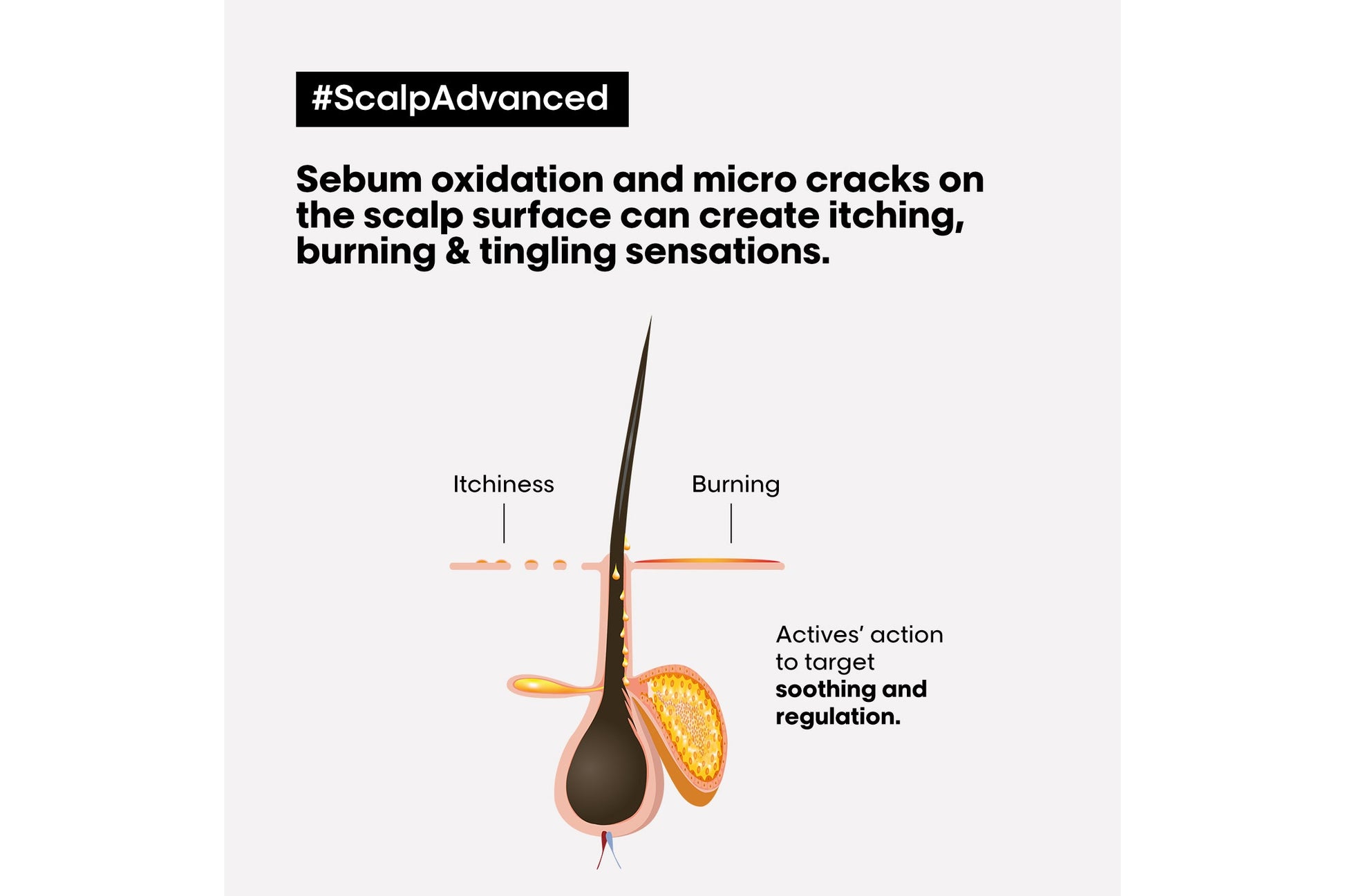 L'Oréal Professionnel Scalp Advanced Discomfort Shampoo 300ml