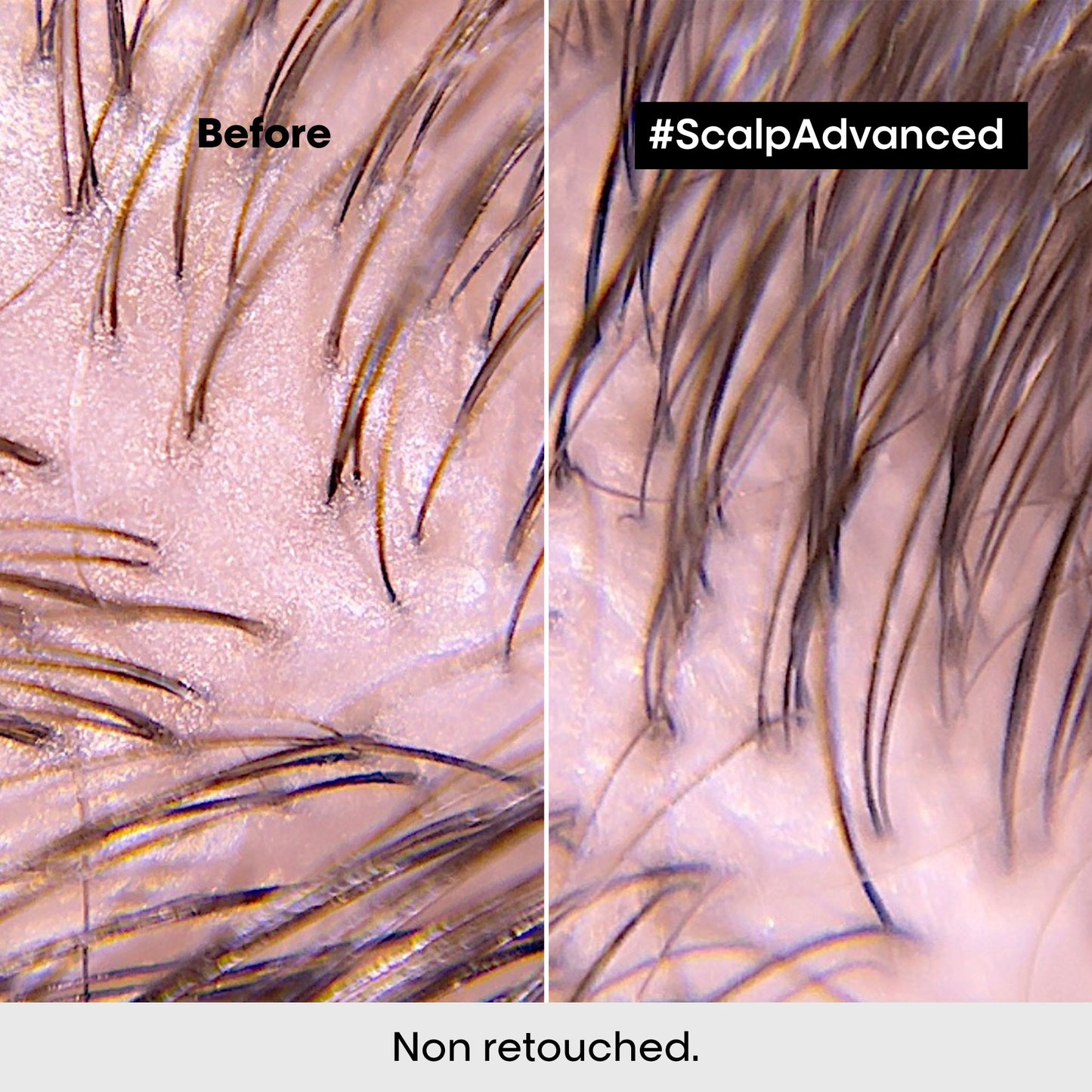L'Oréal Professionnel Scalp Advanced Anti-Discomfort Treatment 200ml