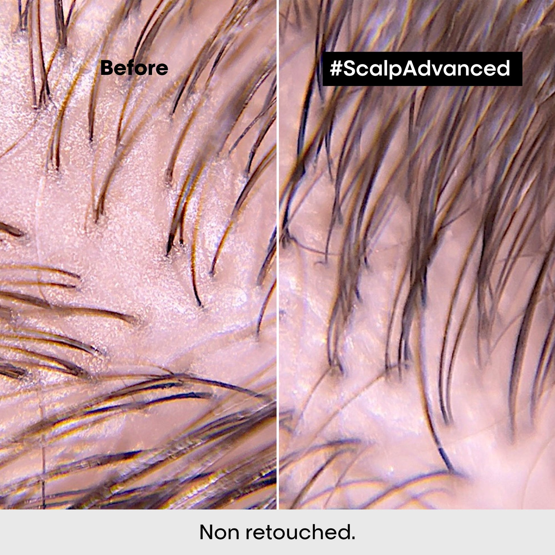 L'Oréal Professionnel Scalp Advanced Anti-Discomfort Treatment 200ml